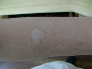 moist egg membrane on skin