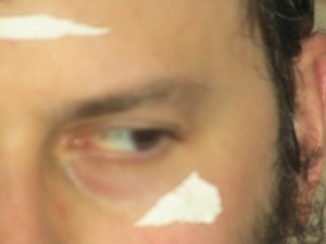 Egg membrane white;a signal of tumah