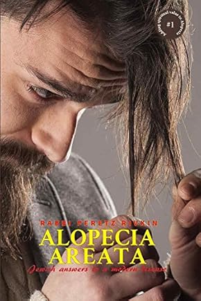 כריכת Alopecia Areata Jewish Answers to a Modern Disease
